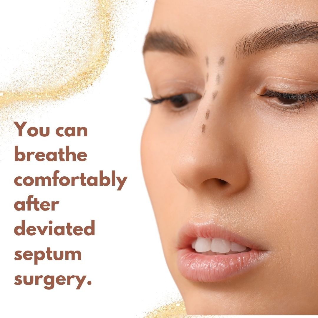 You can breathe comfortably after deviated septum surgery.