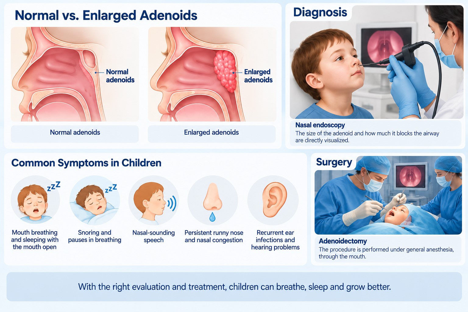 Adenoidectomy treatment procedure in children
