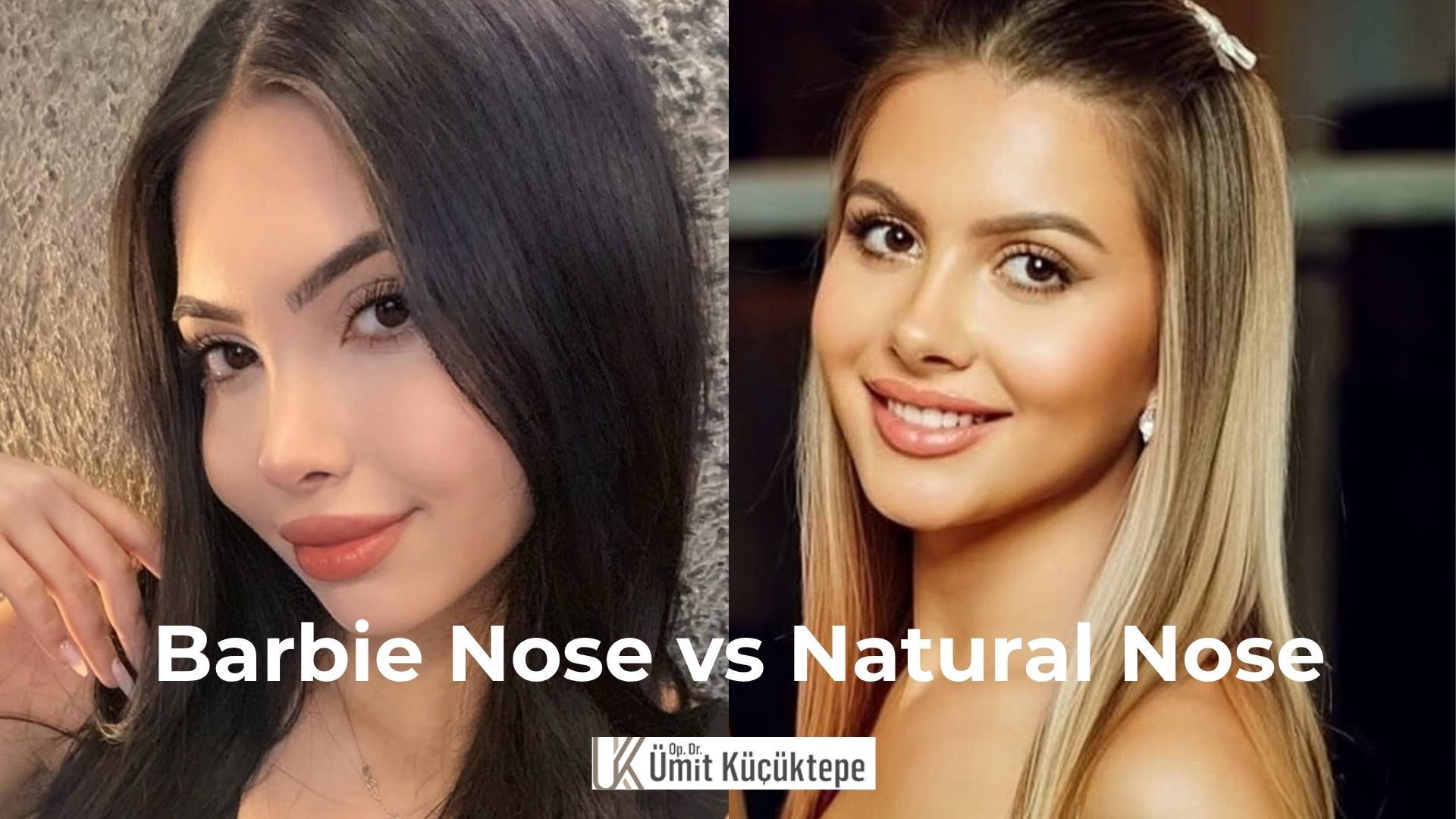 Barbie Nose vs Natural Nose Job  
