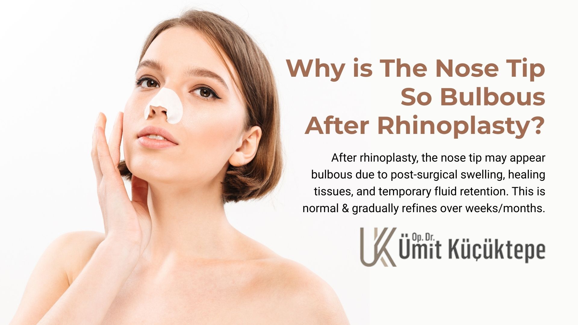 Why is the Nose Tip So Bulbous After Rhinoplasty? 