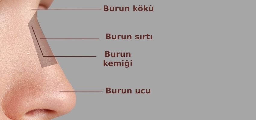 Burun kemeri törpüleme Antalya