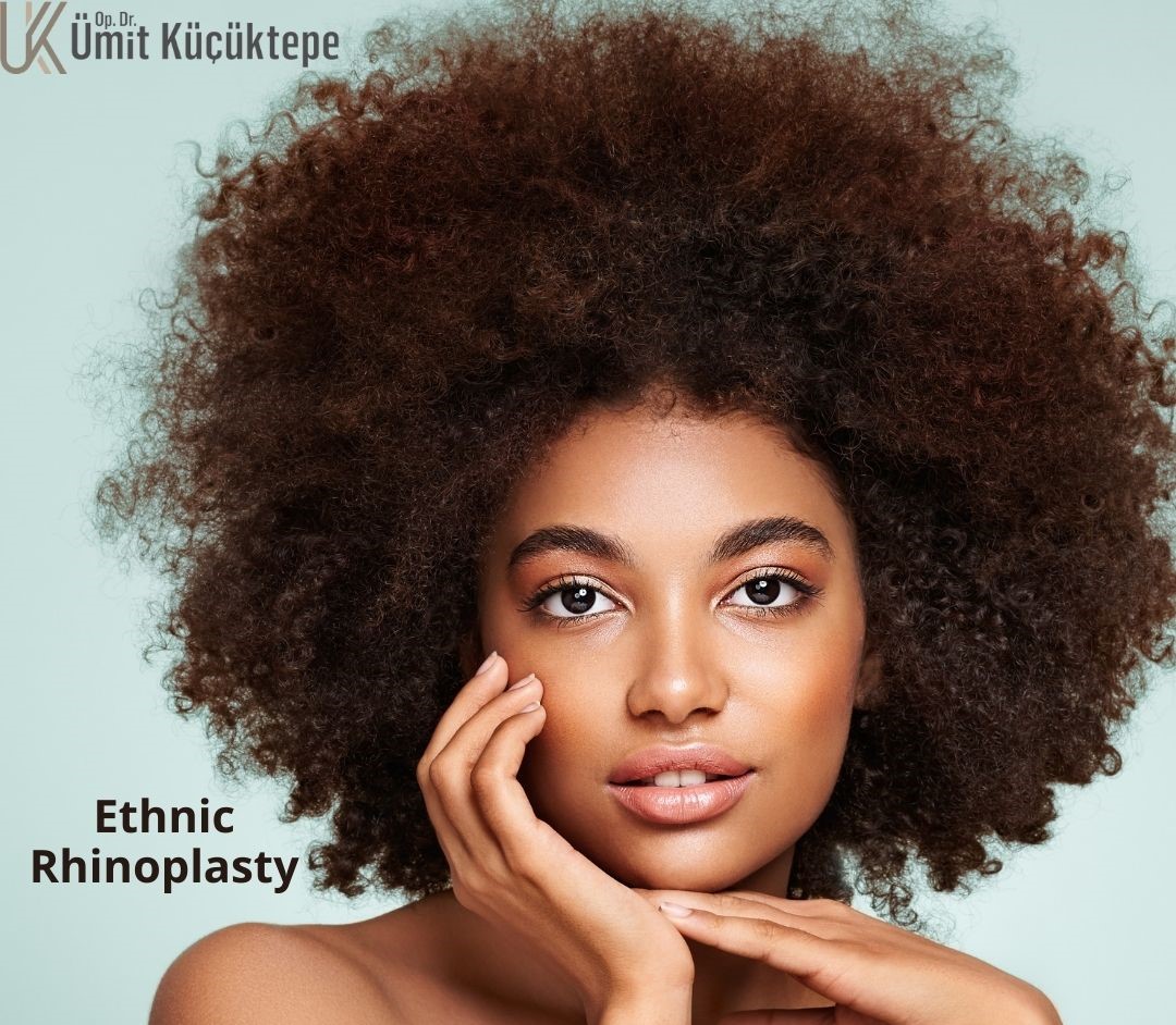 ethnic-rhinoplasty-turkey