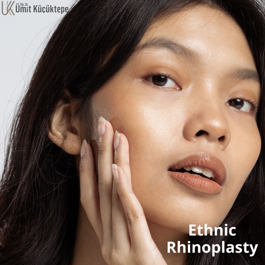 Types of ethnic rhinoplasty