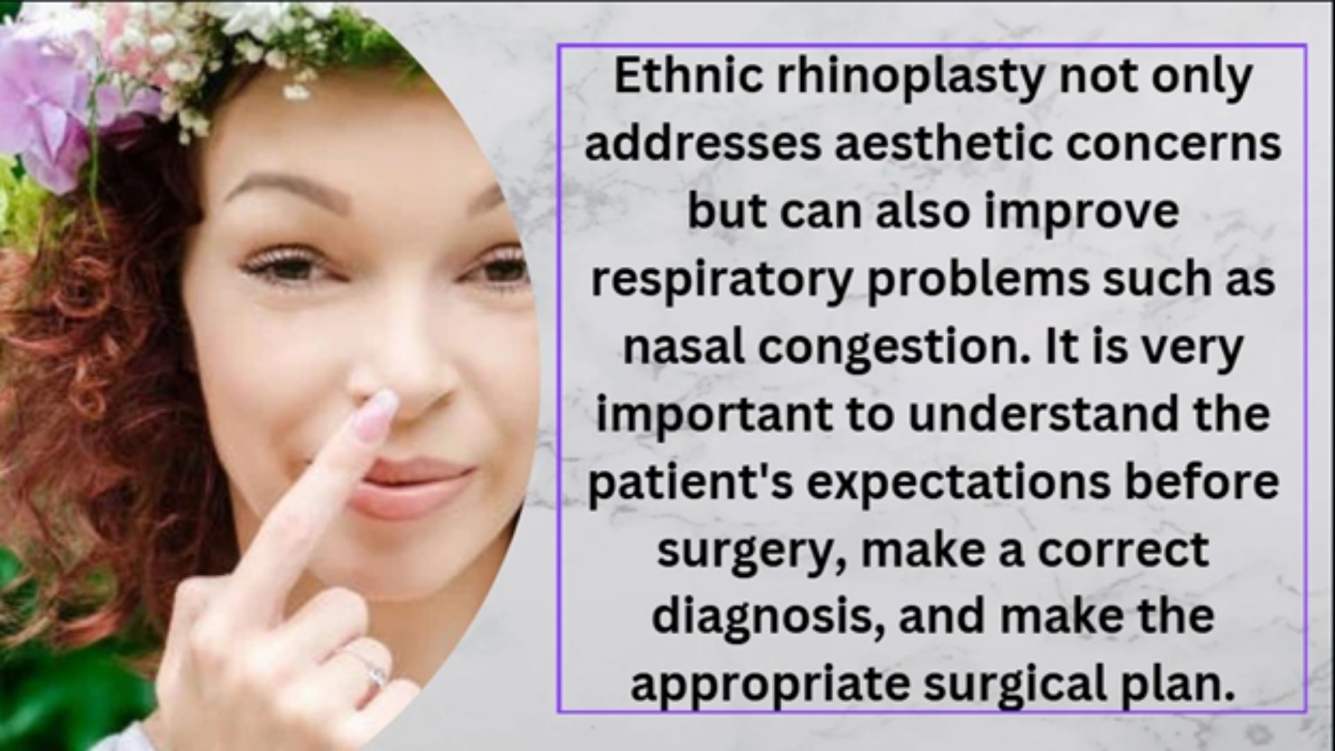 How is ethnic rhinoplasty surgery performed in Turkey?