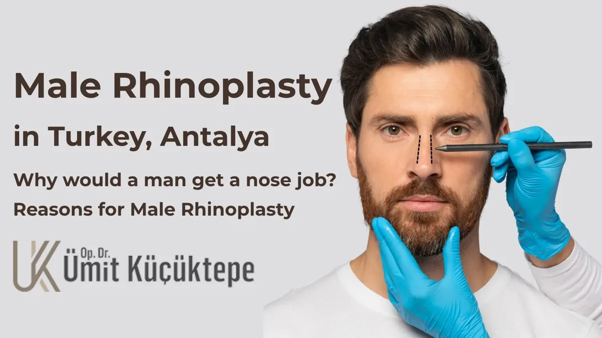 male-rhinoplasty-turkey