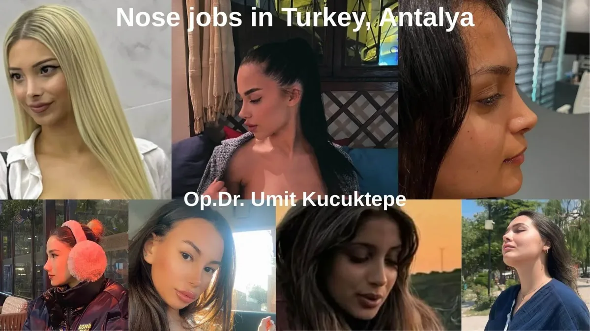 What is the most attractive nose shape?