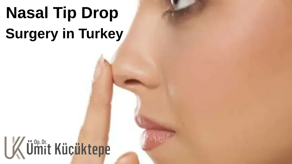 nasal-tip-drop-surgery nasal-tip-drop-surgery-turkey, Antalya