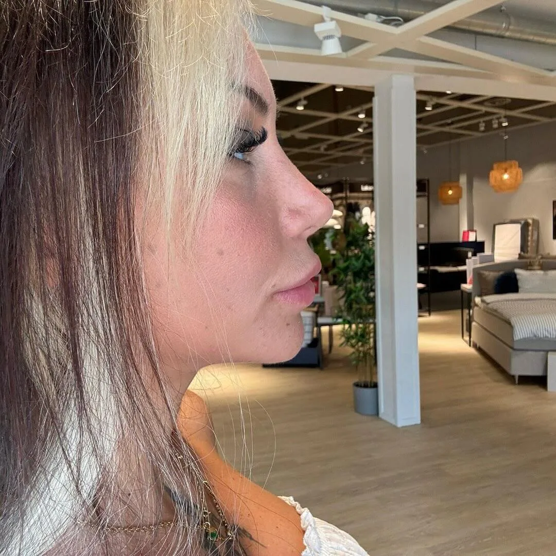 natural-nose-11