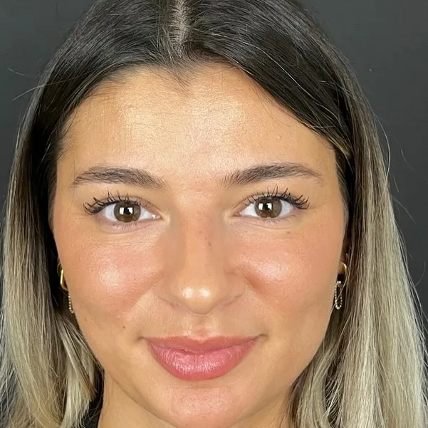 natural-nose-4