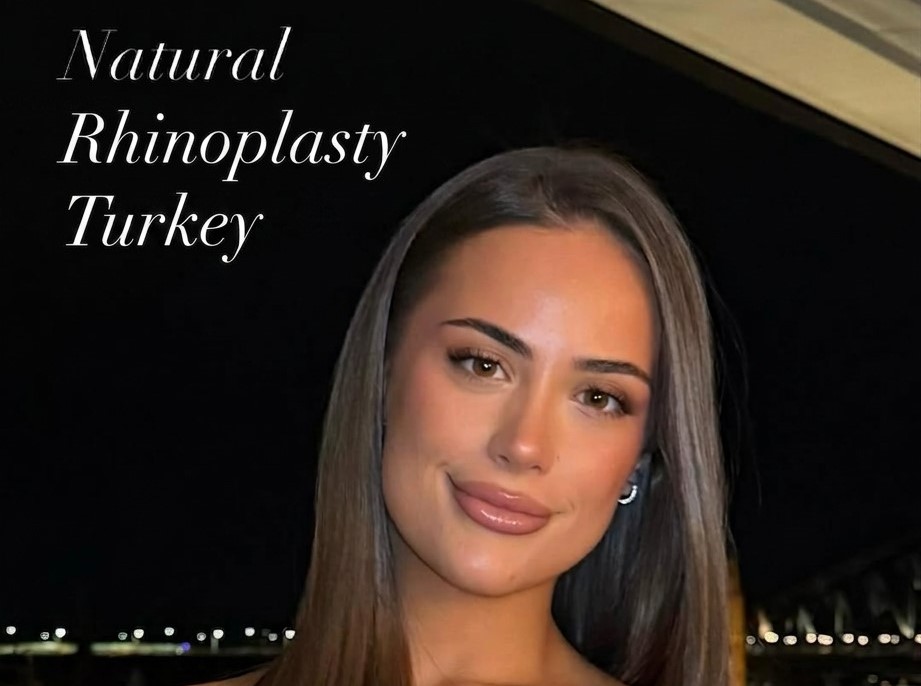  Natural Rhinoplasty in Turkey, Antalya