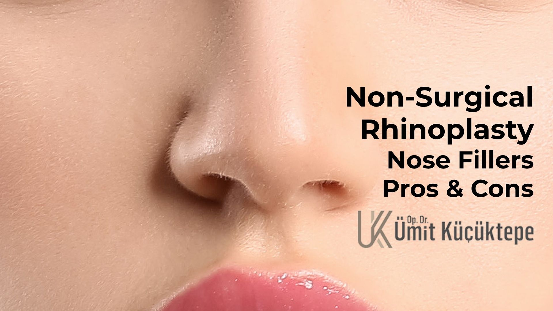Nose fillers: Pros & Cons Nose fillers: Pros & Cons
