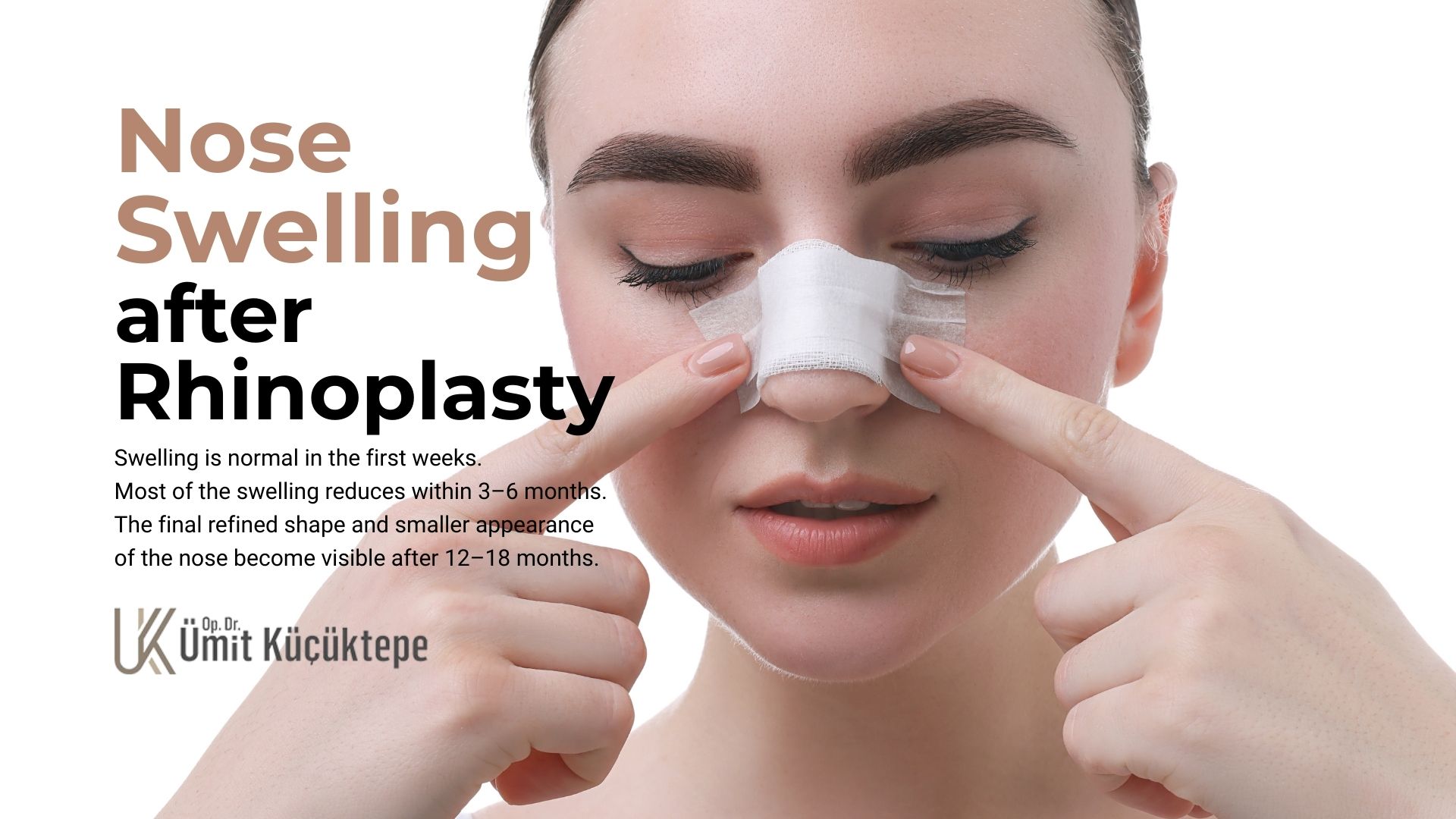 When will my nose get smaller after rhinoplasty? When will my nose get smaller after rhinoplasty?