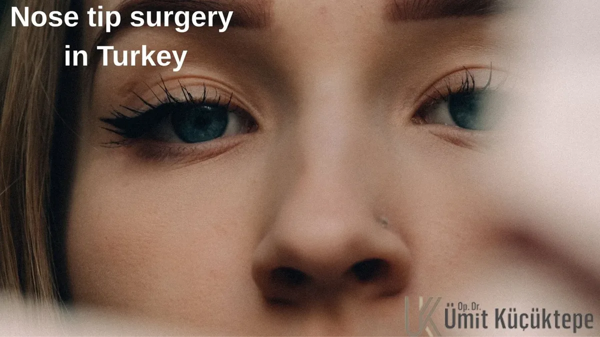 Nose tip surgery in Turkey, Antalya