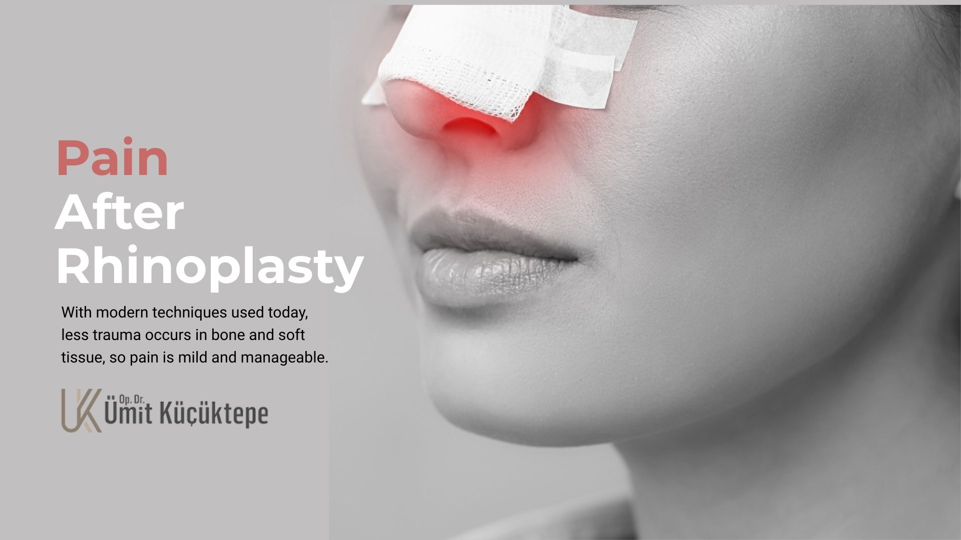 Pain After Rhinoplasty Pain After Rhinoplasty