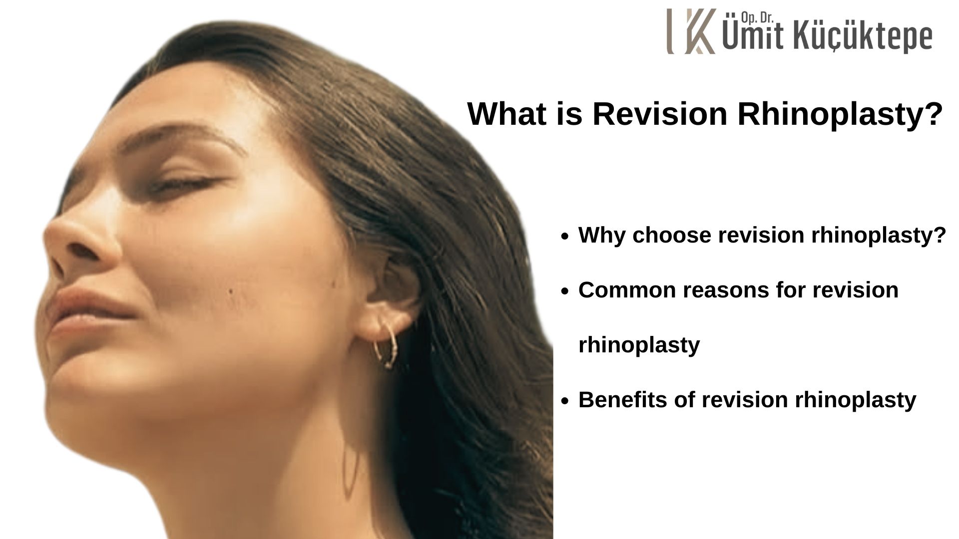 What is Revision Rhinoplasty (Nose Job) in Turkey, Antalya