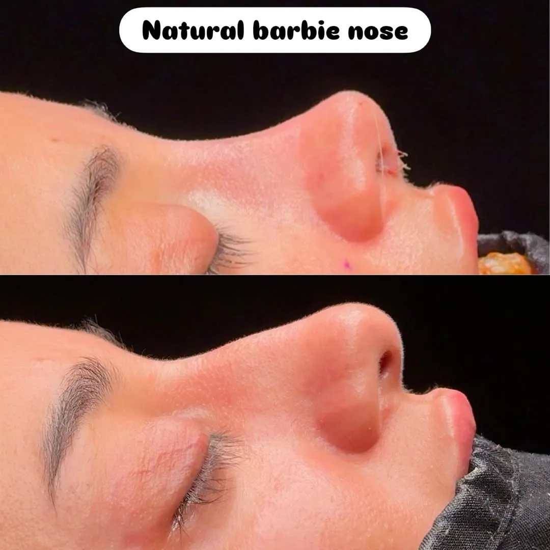 Natural Barbie nose style-1