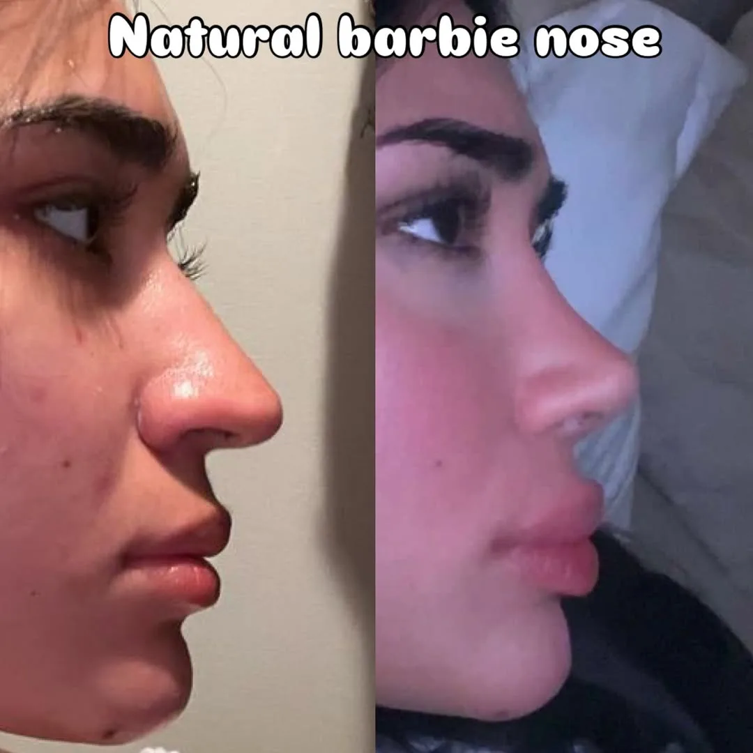 Natural Barbie nose style-2