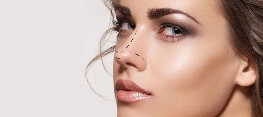 How long does the inside of nose take to heal after surgery? in Turkey, Antalya