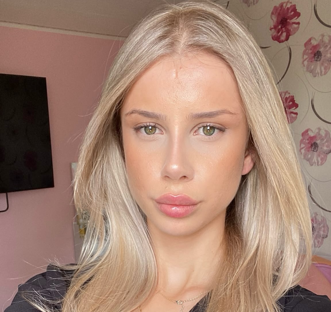 Is It Safe to Get a Nose Job in Turkey?