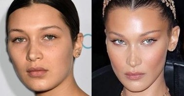 Bella Hadid's eyes before and after Bella Hadid's eyes before and after