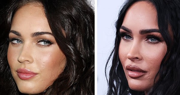 Megan fox eye surgery before and after Megan fox eye surgery before and after