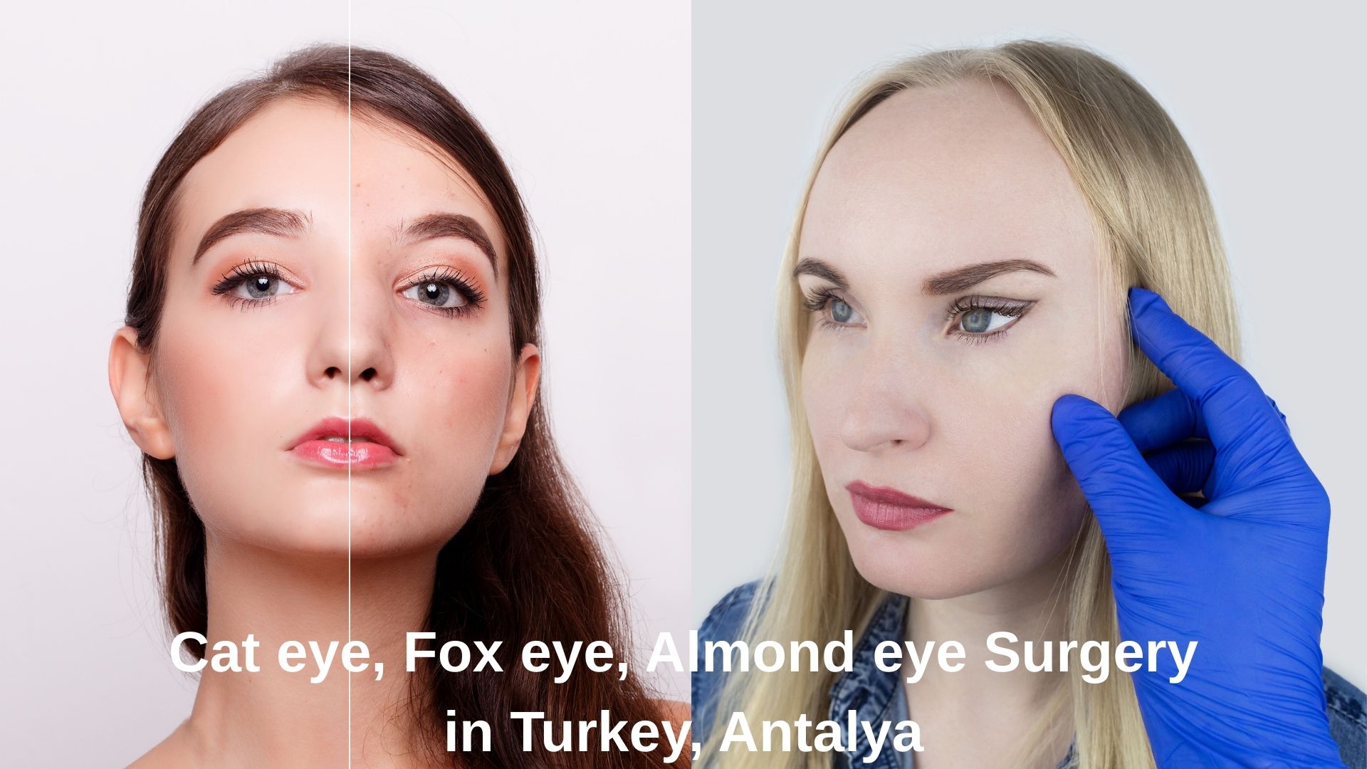 Cat eyes | Fox eyes | Almond eyes Surgery Cat eyes | Fox eyes | Almond eyes surgery Cost in turkey antalya