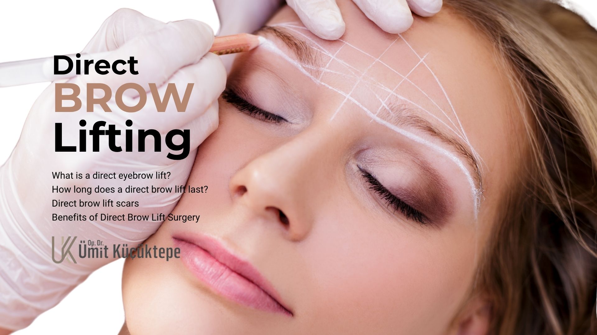 direct-brow-lift-turkey direct brow lifting in turkey antalya