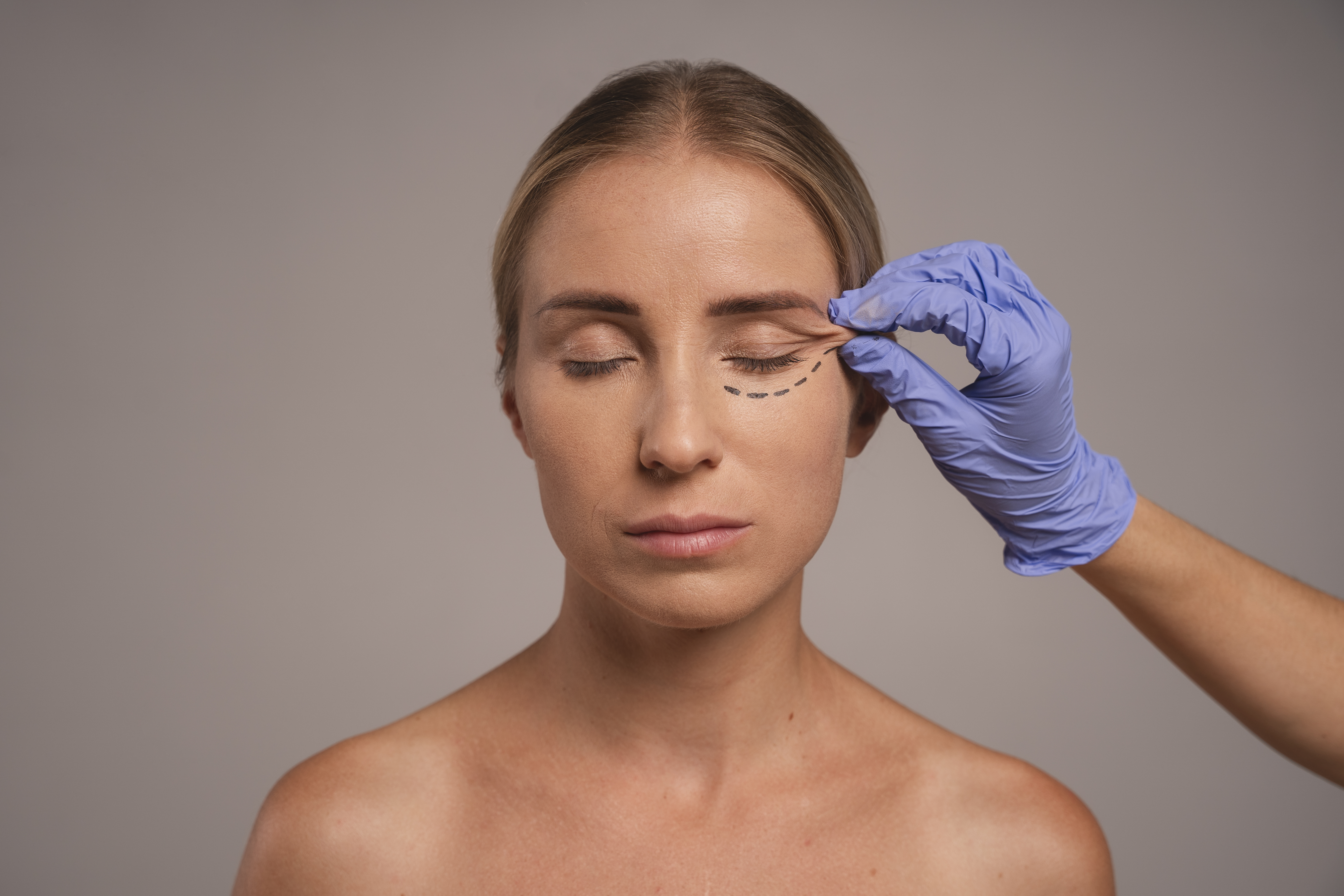 What is an endoscopic temporal lift?