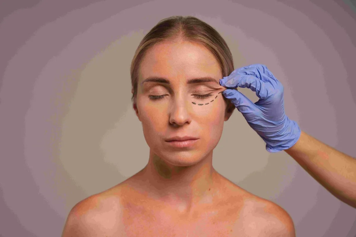 What is an endoscopic temporal lift? What is an endoscopic temporal lift?