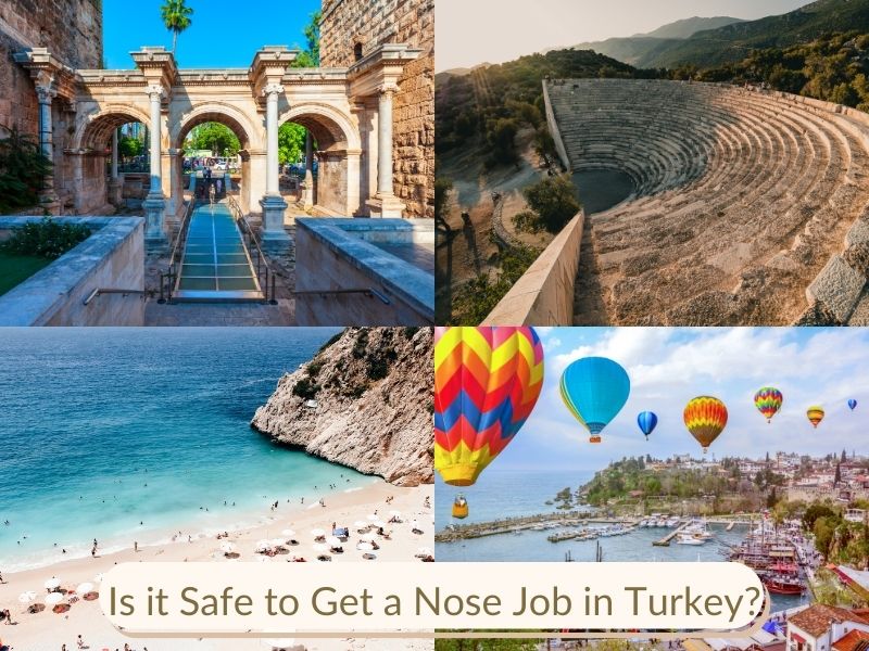 Is it Safe to Get a Nose Job in Turkey?