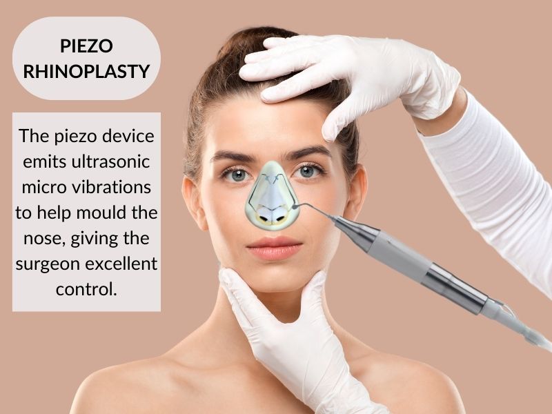 What is piezo rhinoplasty?